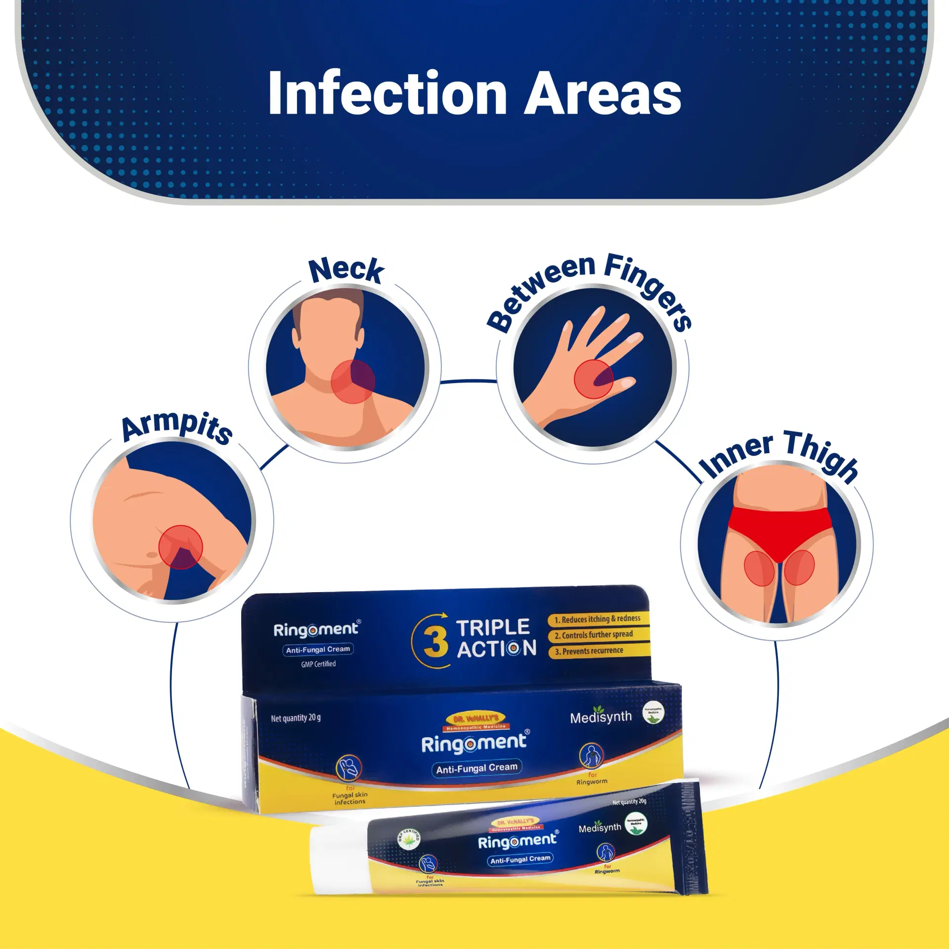 Ringoment Anti-Fungal Cream (Combo Pack of 2- 20g Each) Ringoment Anti-Fungal Cream (Combo Pack of 2- 20g Each) - Image 1